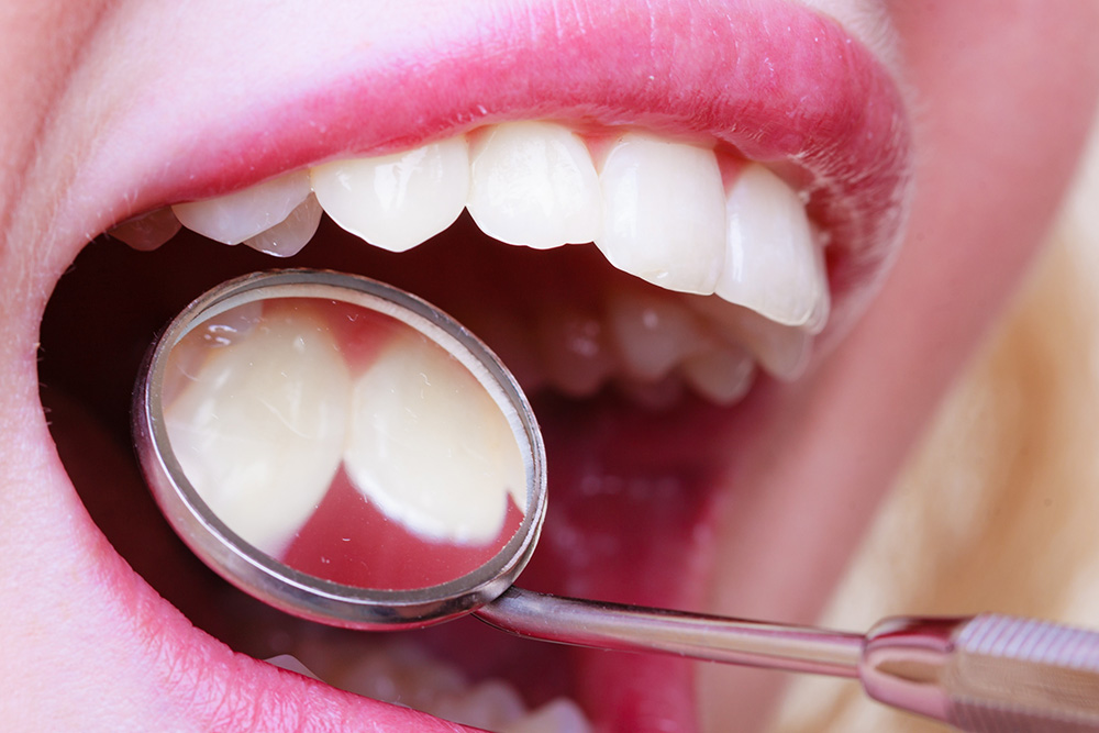 Zahnzusatzversicherung